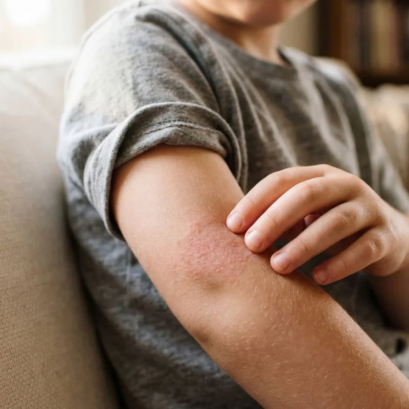Why Your Child’s Eczema Keeps Coming Back (Even After Creams Seem to Work)