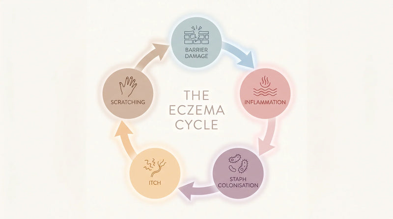 The Eczema Flare Cycle: How Each Stage Triggers the Next (And Where to Intervene)