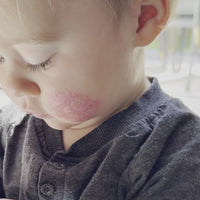 Eczema Soothe & Shield System